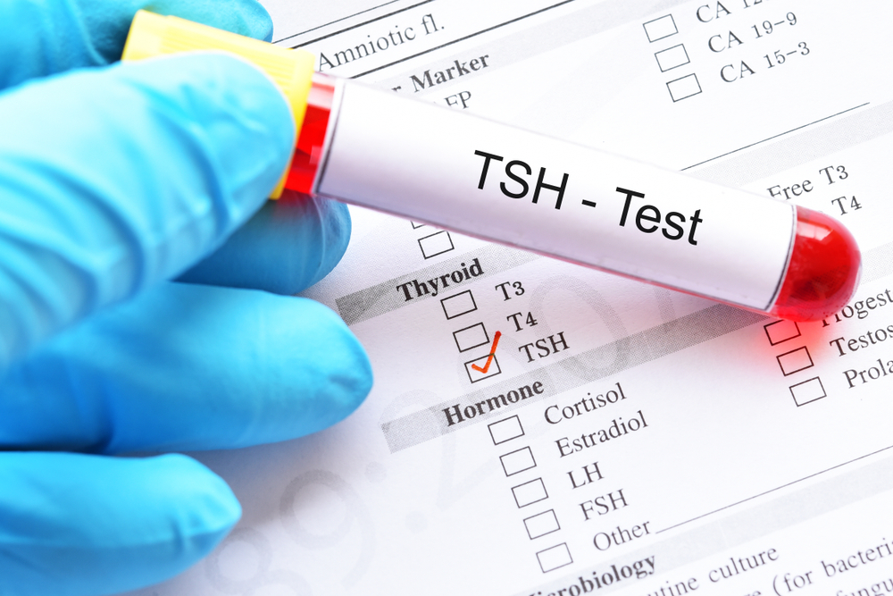 TSH blood test